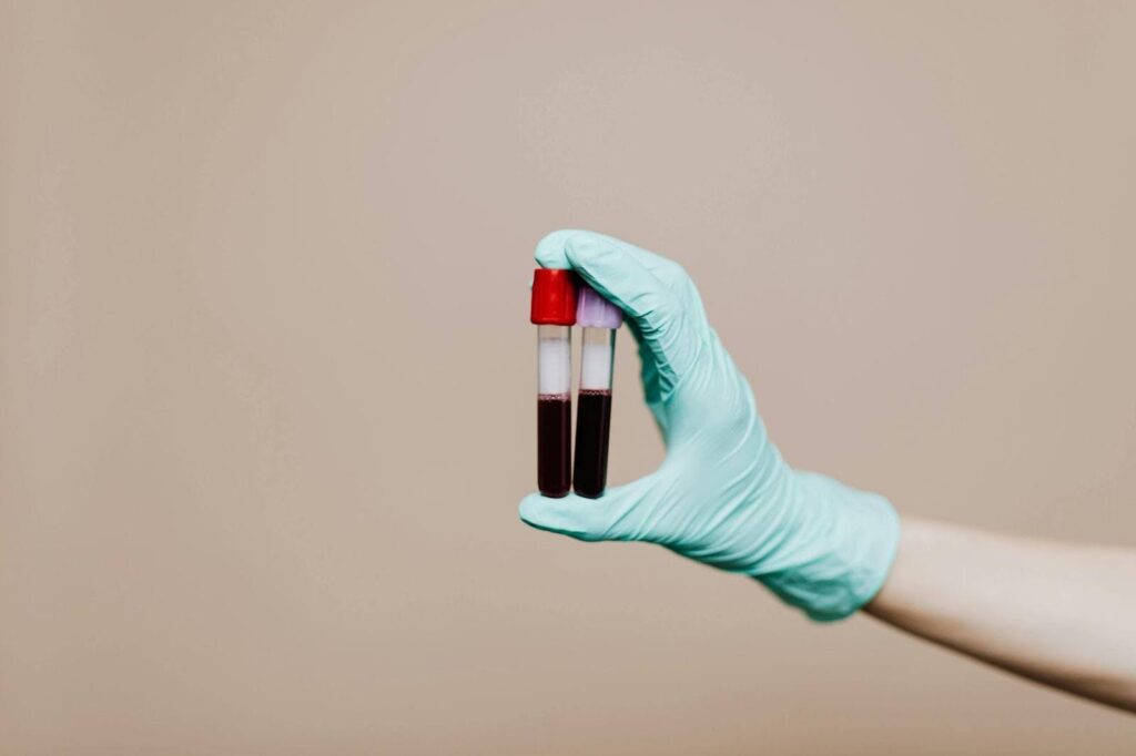 Gloved hand holding two blood test tubes, representing iron testing and ferritin levels in endurance athletes.